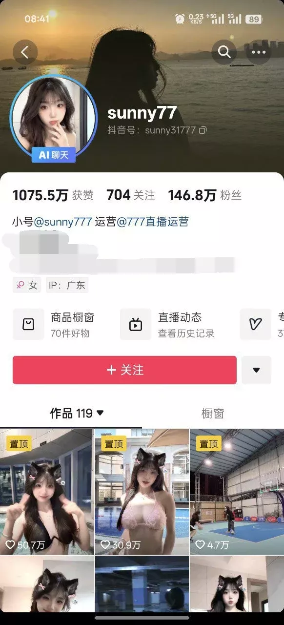 ✅抖音 sunny77/宝贝77-6 150万粉 大尺度骚舞+大尺度自拍等 283V 1